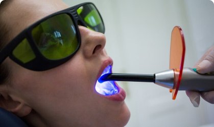 Laser Dentistry