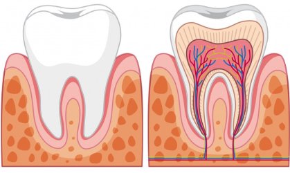 Root Canal Treatment