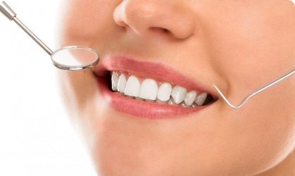 Smile Designing