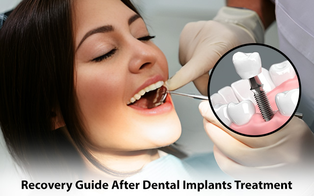 dental implants in Newtown