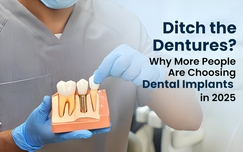 Dental implants