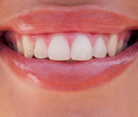 Long-Lasting Results