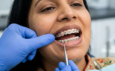 Orthodontic Treatment
